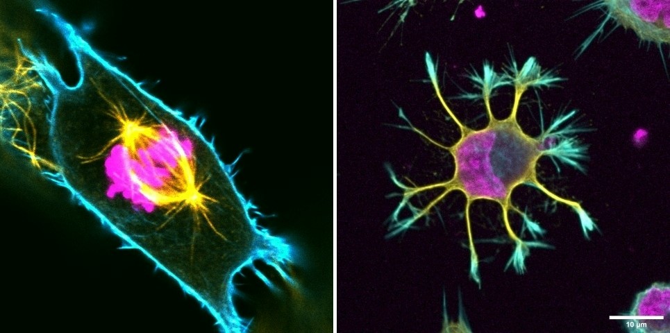 Fig. legend: Cytoskeletal networks show different features and fulfill different functions. Dividing human cancer cell (u2-os, left) and human neuronal precursor in interphase (right). Actin filaments in cyan, microtubules in yellow, DNA in magenta.